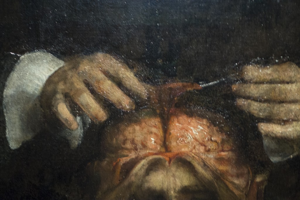 SCALPEL-REMBRANDT-RIJKS-2015-34